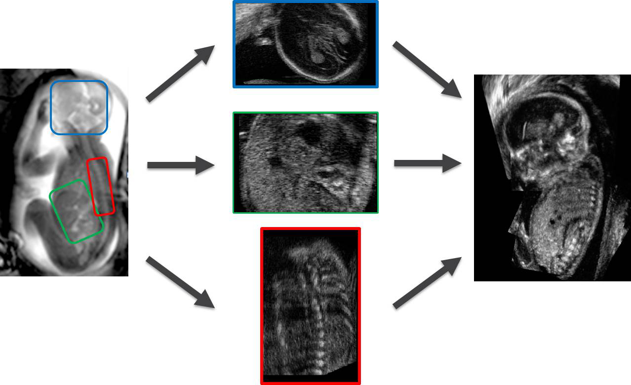 comprehensive fetal MRI